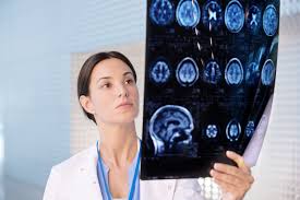 Neurology Scan
